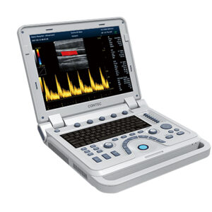 CMS1700A Ultraschall-Diagnosesystem