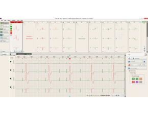 BTL CardioPoint-Holter H100